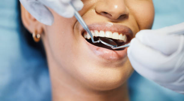 Best Emergency Dental Care for Broken or Chipped Teeth in Battle Mountain, NV