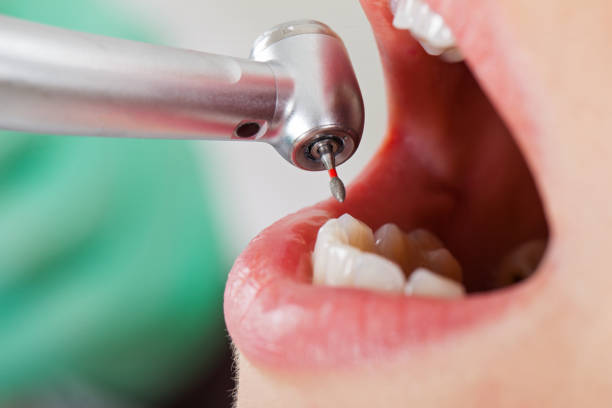 Best Emergency Root Canal Treatment in Battle Mountain, NV